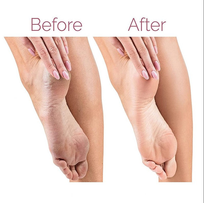 Electric Foot Grinder for Pedicure