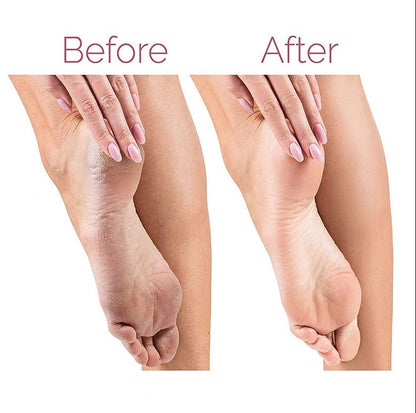 Electric Foot Grinder for Pedicure